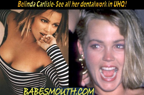 Belinda Carlisle Amalgam Fillings