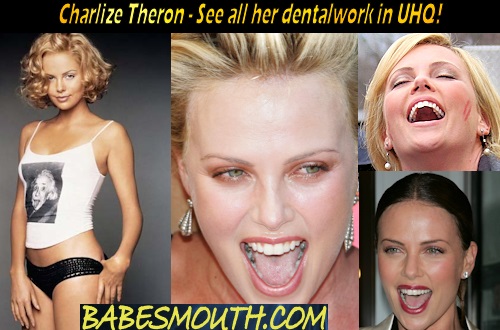 Charlize Theron Amalgam Fillings, Throat, Uvula, Tongue