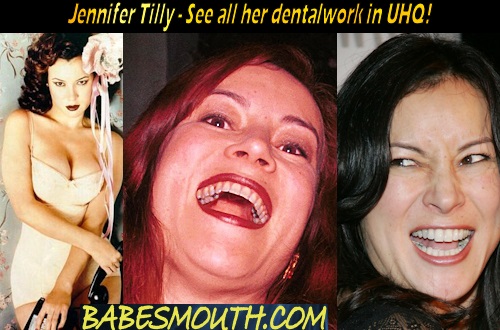 Jennifer Tilly Amalgam Fillings