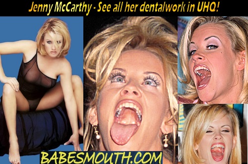 Jenny McCarthy Amalgam Fillings