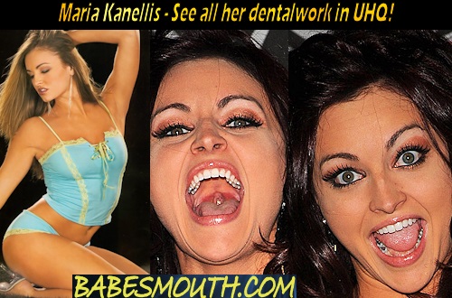 Maria Kanellis Amalgam Fillings