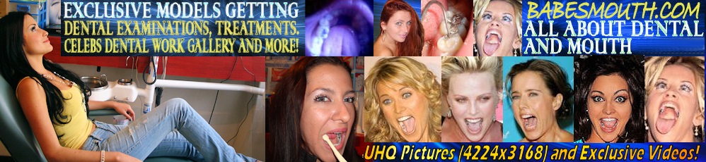 BabesMouth.com Beautiful celebs and girls showing their mouths, teeth, fillings, throats, tongues and all oral related! Dental images, dental cases, mouth tour, inside my mouth.