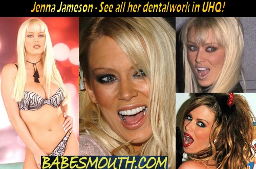 Jenna Jameson Amalgam Fillings